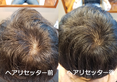 今まで諦めていたヘアースタイルもヘアリセッターで解決