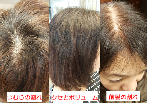 今まで諦めていたヘアースタイルもヘアリセッターで解決