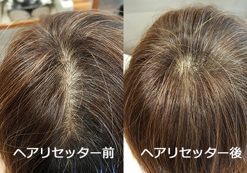 今まで諦めていたヘアースタイルもヘアリセッターで解決